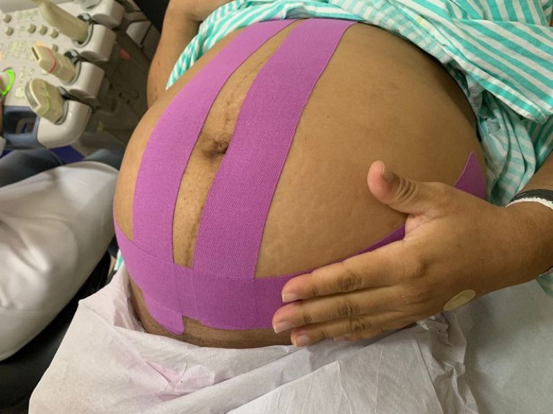 tape_gestacional
